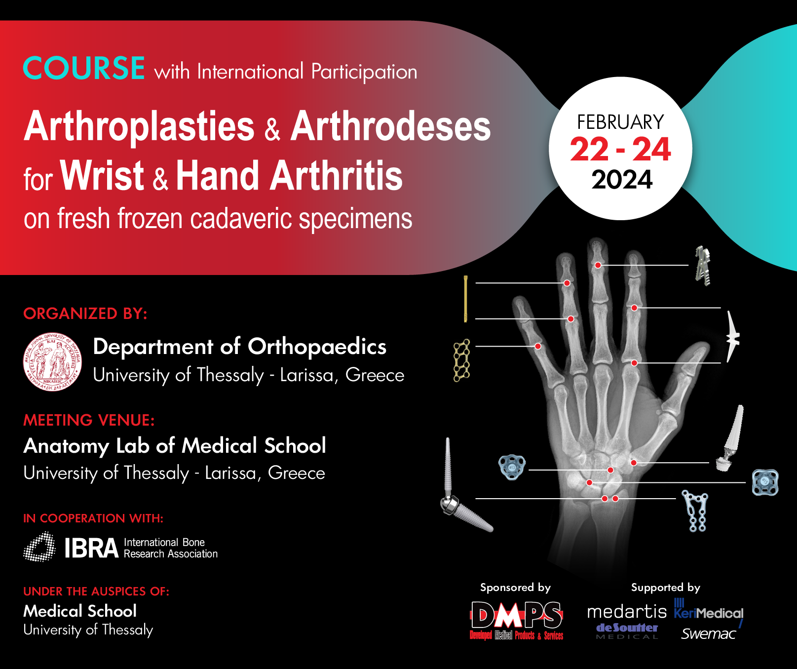 Hands-On Course On Fresh Frozen Cadaveric Specimens | “Arthroplasties ...